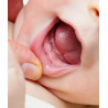 PRANABB GEL GINGIVAL